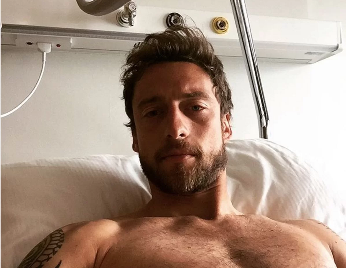 Marchisio, operazione conclusa: “Tutto ok, tranne il volto”. Ritorno all’attività sportiva tra 6 mesi (FOTO)