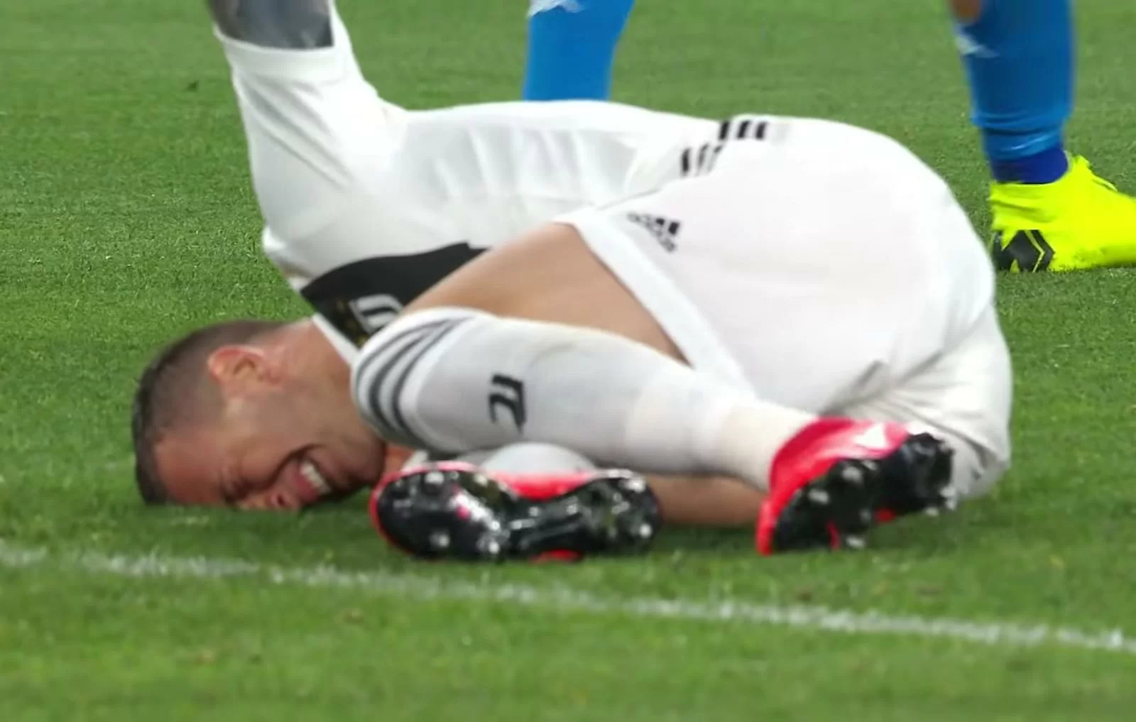 TS | Infortuni Juve: un Aprile da dimenticare