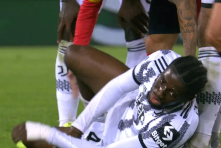 Problemi per Iling e situazione infortuni: parla Allegri