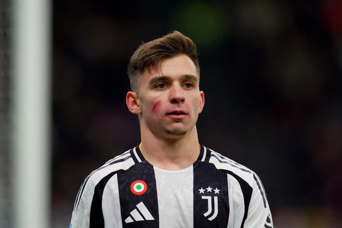 Juve-Venezia, Thiago Motta pensa al cambio: ipotesi panchina per un titolare